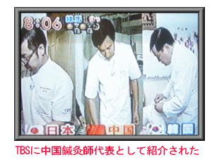 中国鍼灸と三叉神経痛