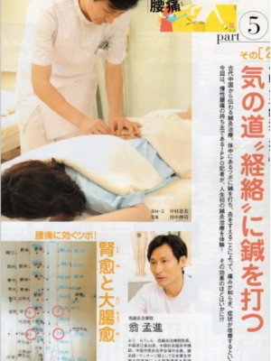 急性腰痛の鍼灸