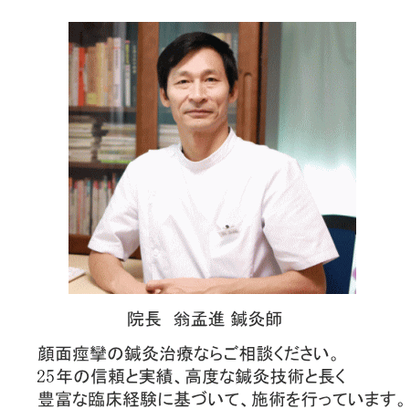 顔面痙攣の鍼灸施術なら 公式 翁鍼灸院 東京都世田谷区 顔面けいれん