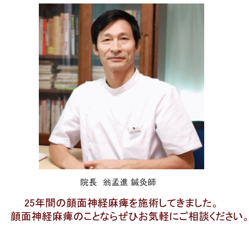 顔面神経麻痺・鍼灸、ベル麻痺の特徴