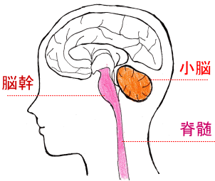 脊髄小脳変性症の症状と原因