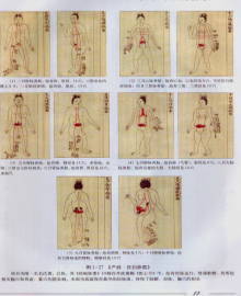 東洋医学と不妊治療