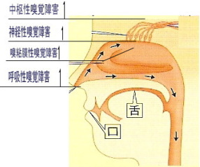 臭覚障害